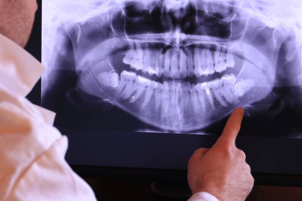 Best Emergency TMJ Treatment in Painted Post, NY